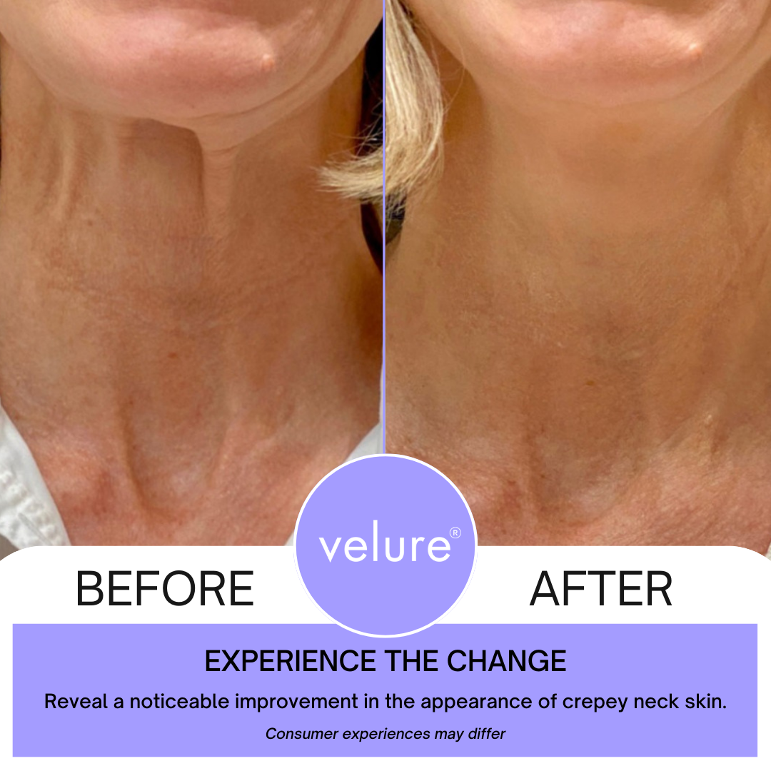 Neck Lift Cream by Velure