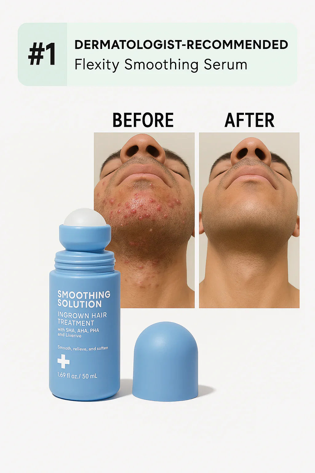 Ingrown Hair + Bump Control Serum