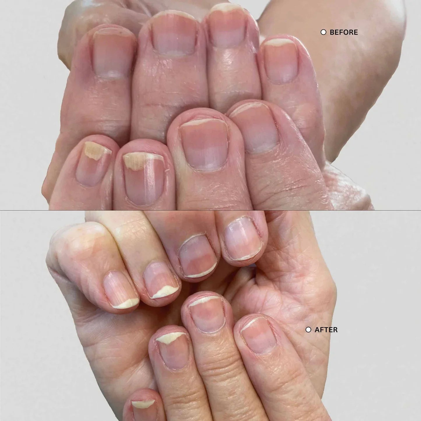 NailBloom™ Repair & Growth Pen