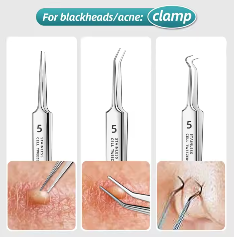 Premium Blackhead Needle Sets (8PCS)