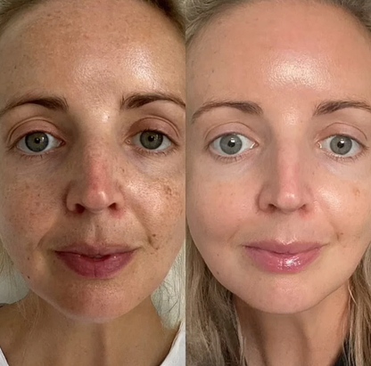 PureA313 - Vitamin A & Retinol Cream