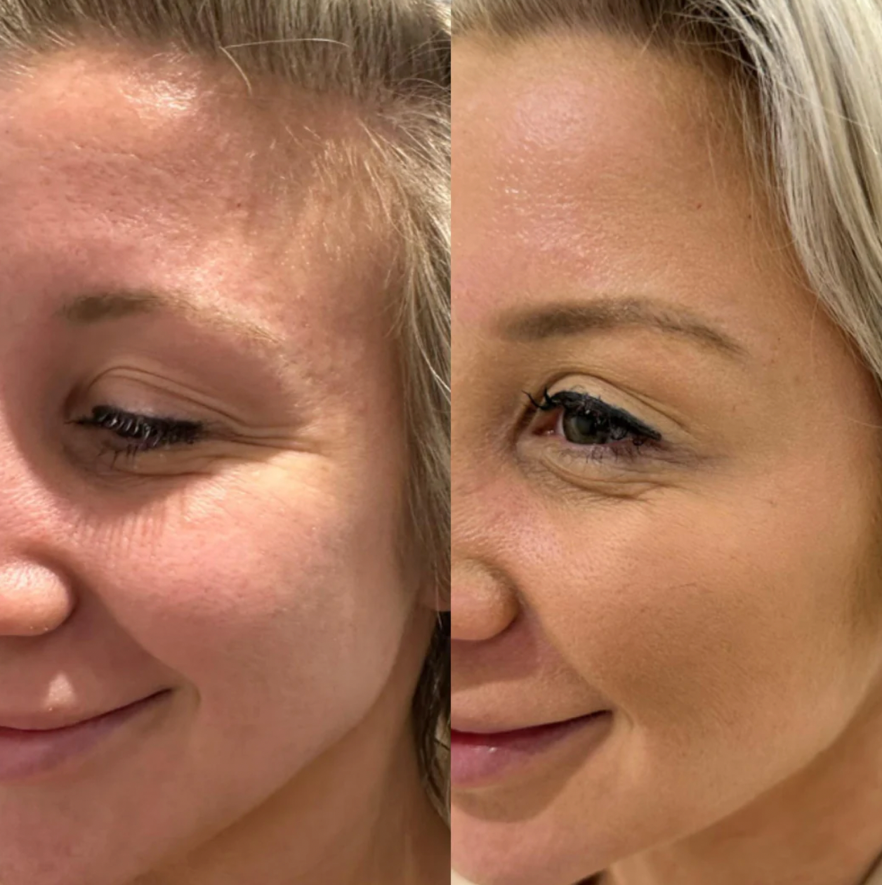 PureA313 - Vitamin A & Retinol Cream