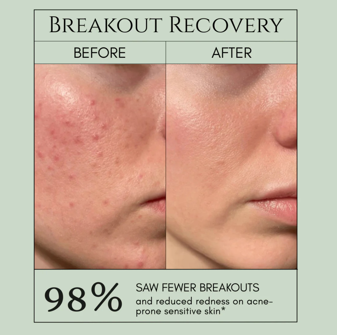 Holy Basil Bubble Mask