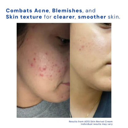 PureA313 - Vitamin A & Retinol Cream